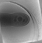 key visualization for L. pneumophila JV1181