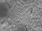 key visualization for Plasma membranes isolated by unroofing - Grid 02