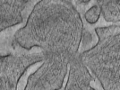 key visualization for Plasma membranes isolated by unroofing - Grid 04