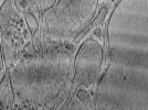 key visualization for Plasma membranes isolated by unroofing - Grid 05