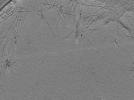 key visualization for ASB1tomo1162