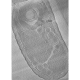 key visualization for Cryo-ET dataset (3) of dormant microporidian spores from Encephalitozoon intestinalis