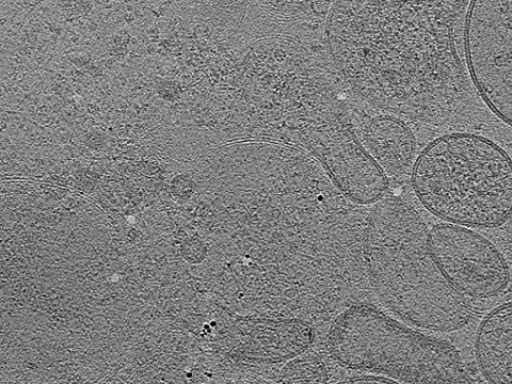 key visualization for tomogram_017