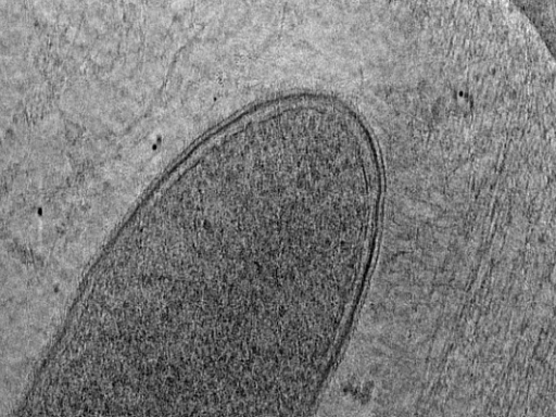 key visualization for Cryo-ET of Rickettsia parkeri wild-type in infected A549 cells (3.7 A, UW-Madison K3)