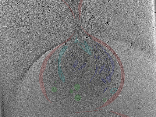 key visualization for Cryo-electron tomography of axons and varicosities in cultured primary mouse dorsal root ganglion neurons (Titan Krios, 31 July - 1 August 2025)