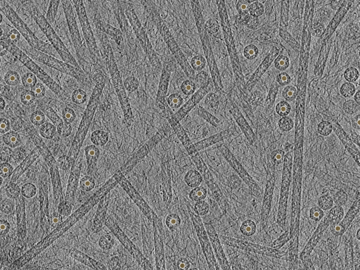 key visualization for pt152_ts_002