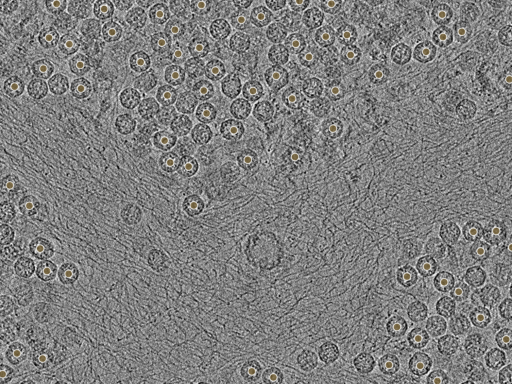 key visualization for pt184_ts_002