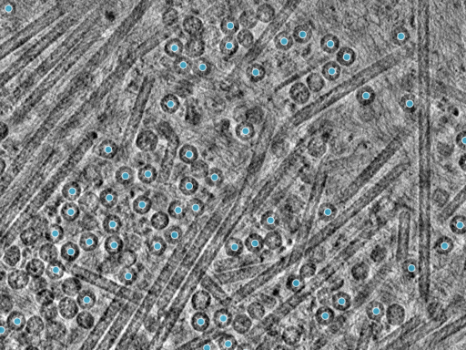 key visualization for PP7 virus-like particles in E. coli imaged with the crossed laser phase plate (xLPP) at 2-3 µm underfocus