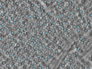 key visualization for pt453_ts_002