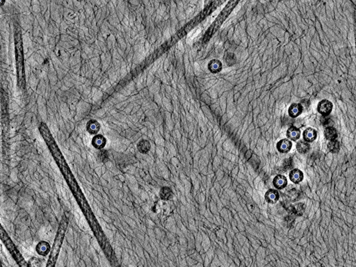 key visualization for PP7 virus-like particles in E. coli imaged with the crossed laser phase plate (xLPP) at 0.5-1.5 µm underfocus