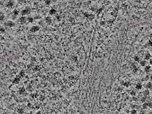 key visualization for L1_P1_ts_004