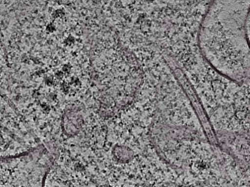 key visualization for L1_P2_ts_005