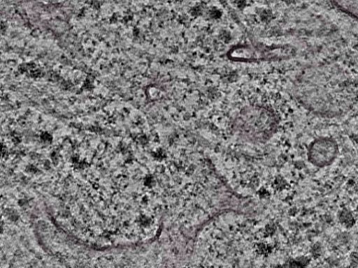 key visualization for L1_P2_ts_007