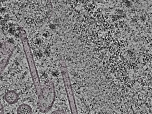 key visualization for L1_P2_ts_010