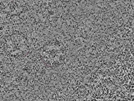 key visualization for L1_ts_006