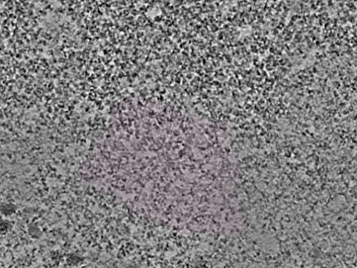 key visualization for L1_ts_015