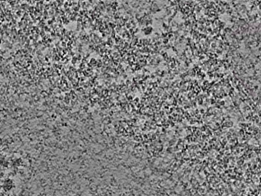 key visualization for L2_ts_005