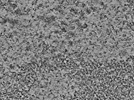 key visualization for L2_ts_004