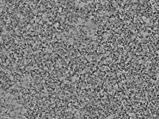 key visualization for L5_ts_006