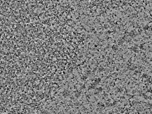 key visualization for L5_ts_009