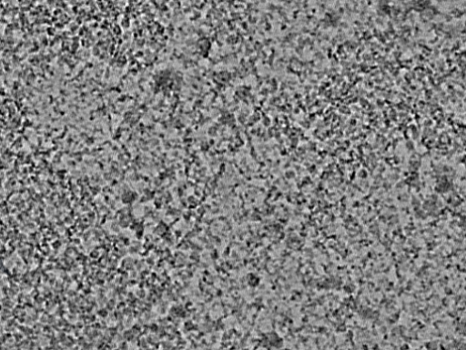 key visualization for L5_ts_010