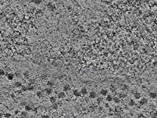 key visualization for L14_ts_006