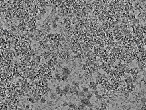 key visualization for L9_ts_004