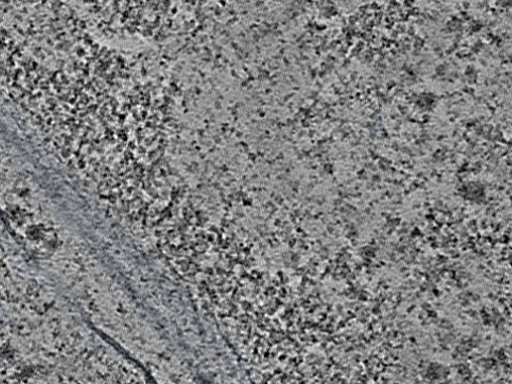key visualization for L9_ts_013