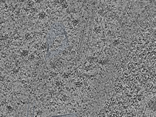 key visualization for Cryo-FIB-milled NIH/3T3 mouse fibroblasts (dataset 6)