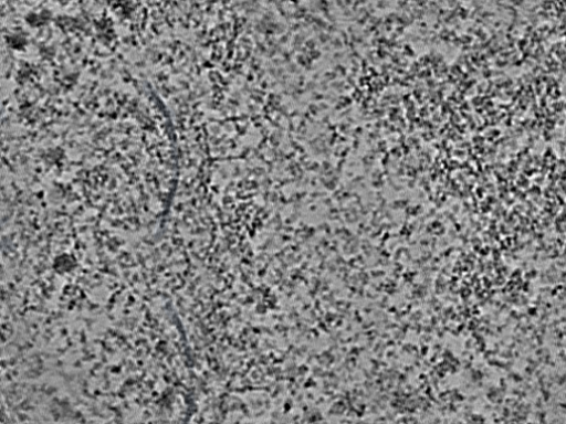 key visualization for L1_ts_003