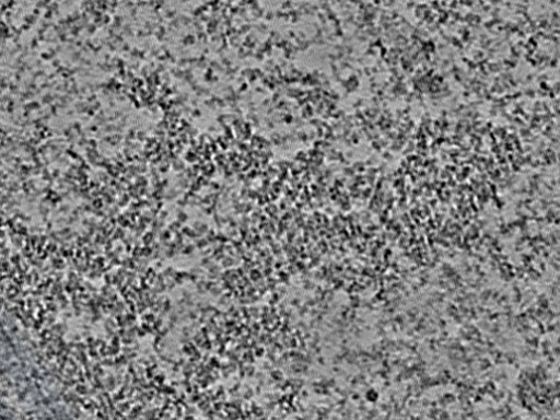 key visualization for L1_ts_006