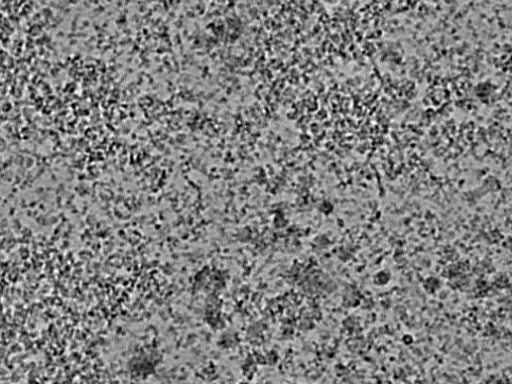 key visualization for L1_ts_010
