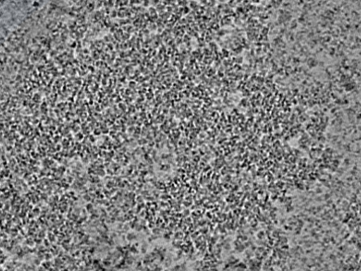 key visualization for L2_ts_007