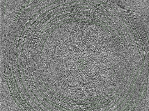 key visualization for Cryo-electron tomography of a cryo-FIB lift-out from adult mouse cortex