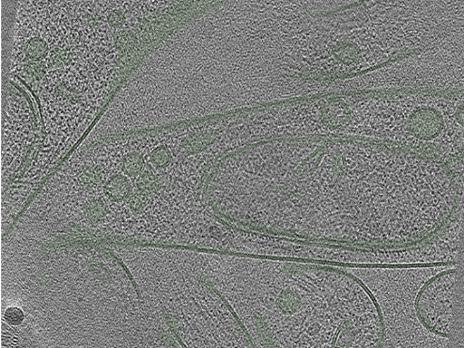 key visualization for Cryo-electron tomography of a cryo-FIB lift-out from adult mouse hippocampal CA1 stratum radiatum (dataset 3)