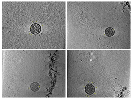 key visualization for Structures and distributions of severe acute respiratory syndrome coronavirus 2 spike proteins