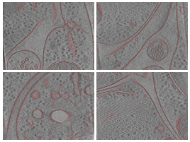 key visualization for Membrane segmentations of denoised tomograms