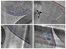 key visualization for In situ architecture of the polar tube invasion apparatus from microsporidian parasites