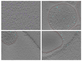 key visualization for CryoET of near-minimal cells Mycoplasma mycoides JCVI-Syn3A for the development of subtomogram averaging pipelines