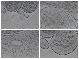 key visualization for Cryo-ET of isolated segments of synaptic terminals, synaptosomes, from rat hippocampi