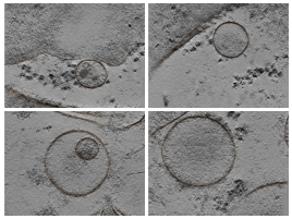 key visualization for Affinity-Captured Endo-/Lysosomes