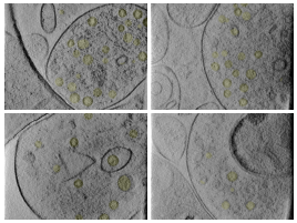 key visualization for Automated Synaptic Vesicle Segmentation in Synaptosomes