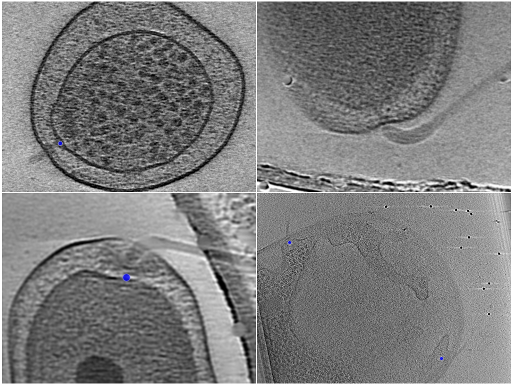 key visualization for BYU - Locating Bacterial Flagellar Motors Challenge Train Annotations