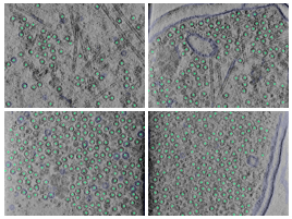 key visualization for In situ virus-like particles in E. coli for microscopy and pipeline benchmarking