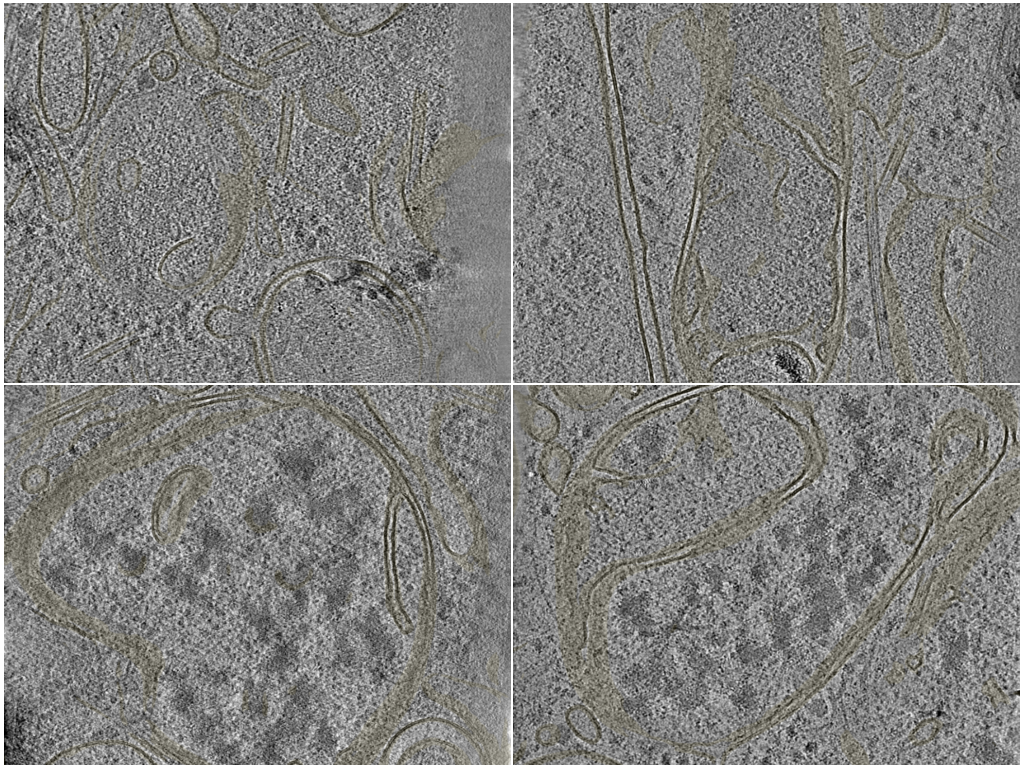 key visualization for Cryo-electron tomography of HeLa cells under mitochondrial proteostatic stress