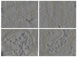 key visualization for Cryo-electron tomography of HeLa cells under mitochondrial proteostatic stress