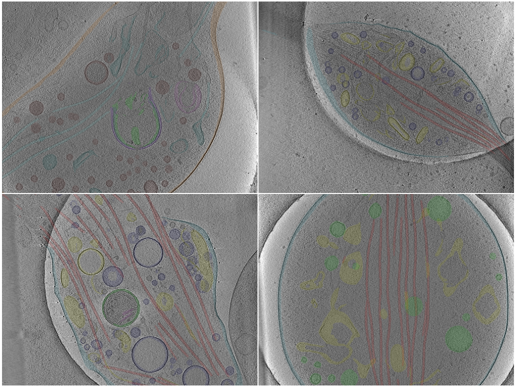 key visualization for Cryo-electron tomography of axons and varicosities in cultured primary mouse dorsal root ganglion neurons (baseline data and annotations)