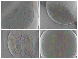 key visualization for Cryo-electron tomography of axons and varicosities in cultured primary mouse dorsal root ganglion neurons (baseline data and annotations)