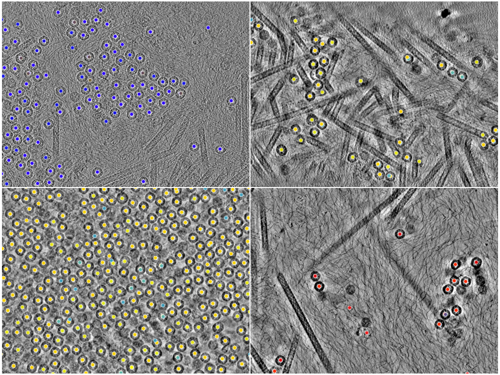key visualization for Crossed laser phase plate (xLPP) tomography of PP7 virus-like particles in E. coli: a matched-grid comparison with underfocus phase contrast