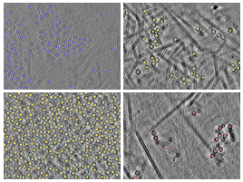 key visualization for Crossed laser phase plate (xLPP) tomography of PP7 virus-like particles in E. coli: a matched-grid comparison with underfocus phase contrast